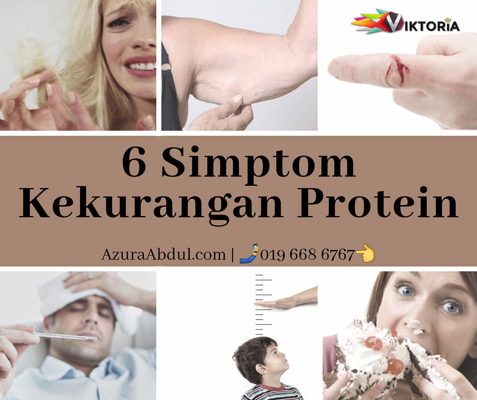 6 Simptom Kekurangan Protein
